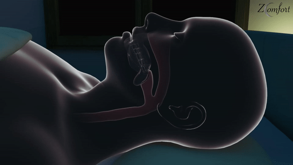 ezgif.com-video-to-gif (4).gif__PID:96580129-e6a6-4017-8978-2947231b495d